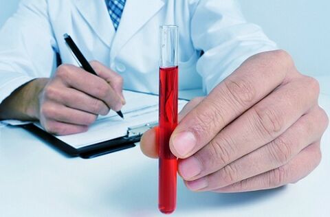 tests sanguins pour identifier les parasites