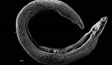 Quels parasites peuvent vivre dans le foie d'une personne